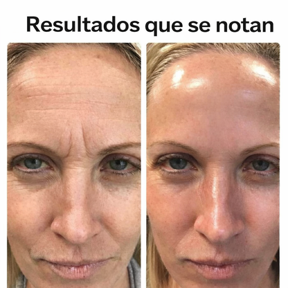 Retinal Shot ★ Para una piel más joven y brillante